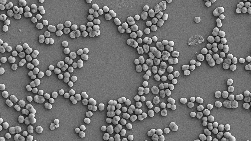 acinetobacter baumannii: an emerging superbug

